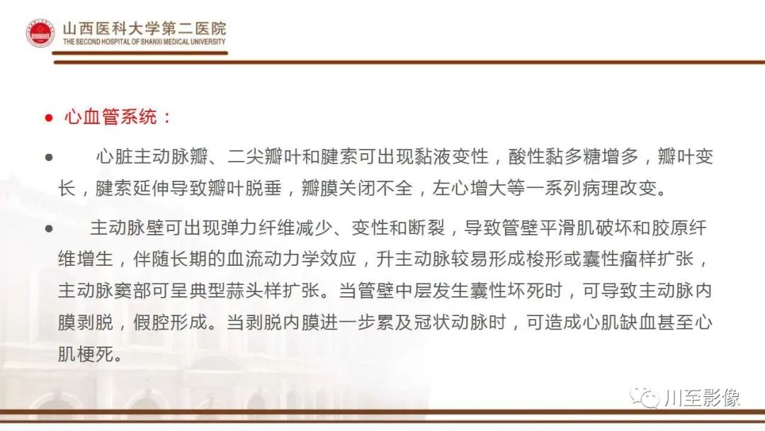 影像PPT - 【PPT】马方综合征-7