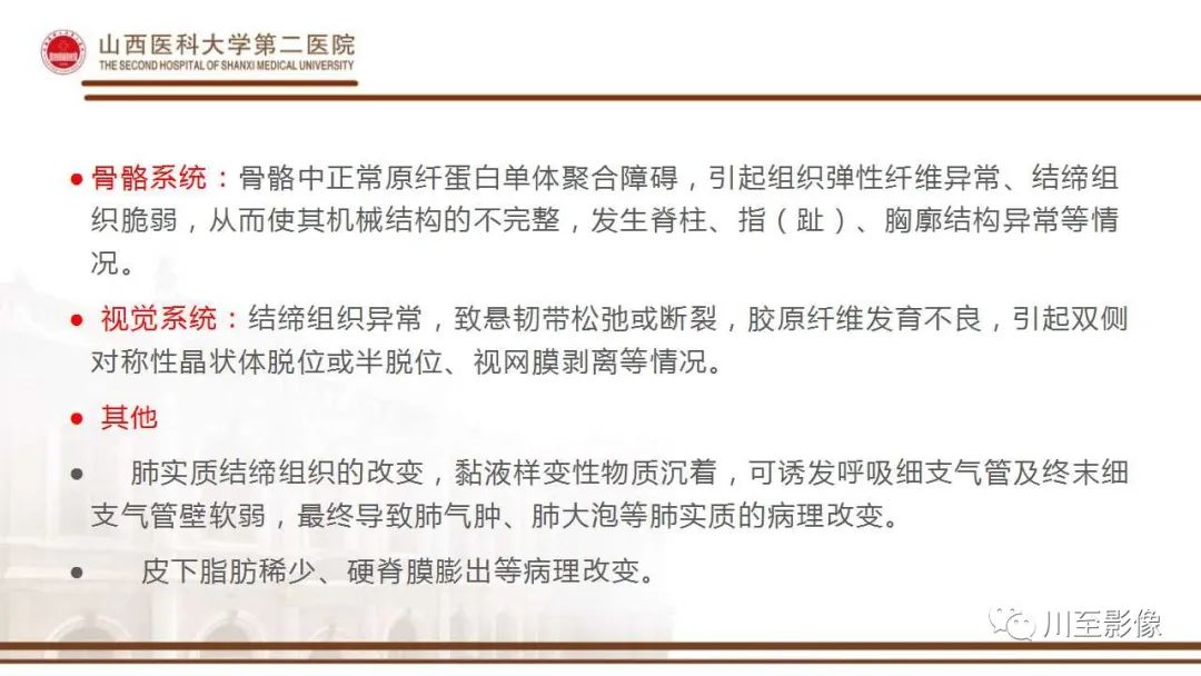 影像PPT - 【PPT】马方综合征-8