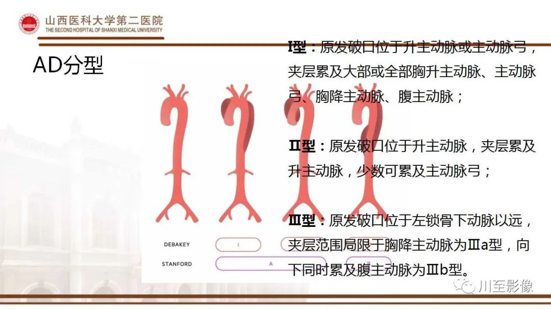 影像PPT - 【PPT】马方综合征-11