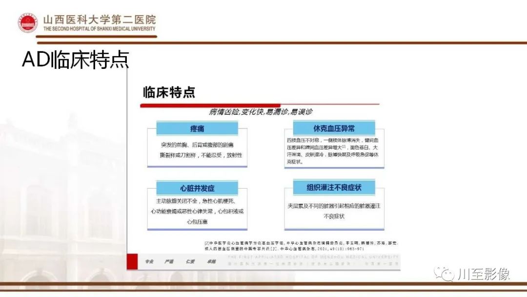 影像PPT - 【PPT】马方综合征-12