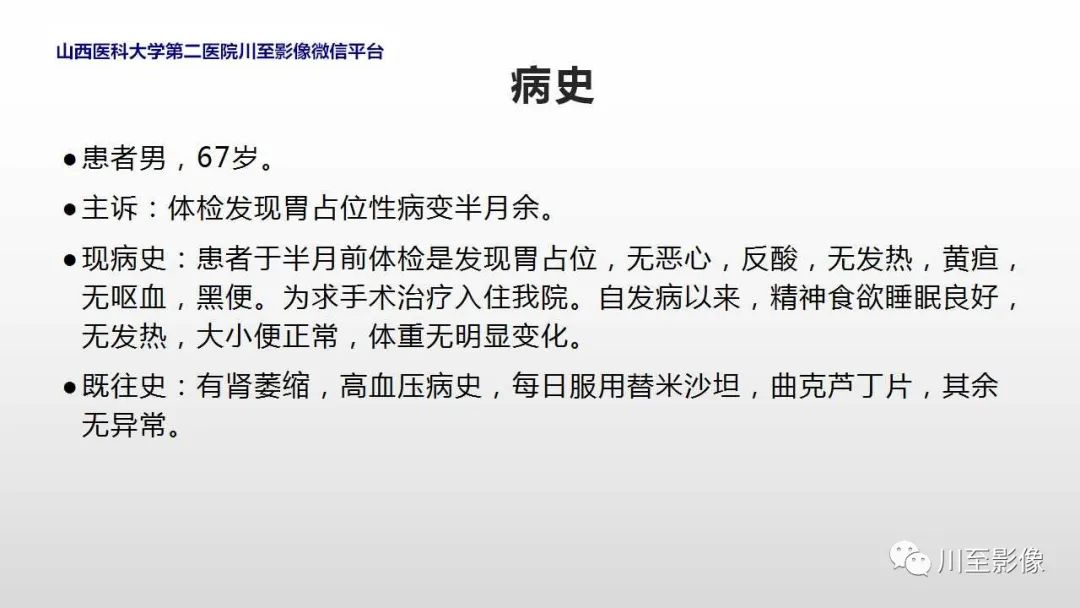 影像PPT - 【PPT】胃肠道间质瘤-2