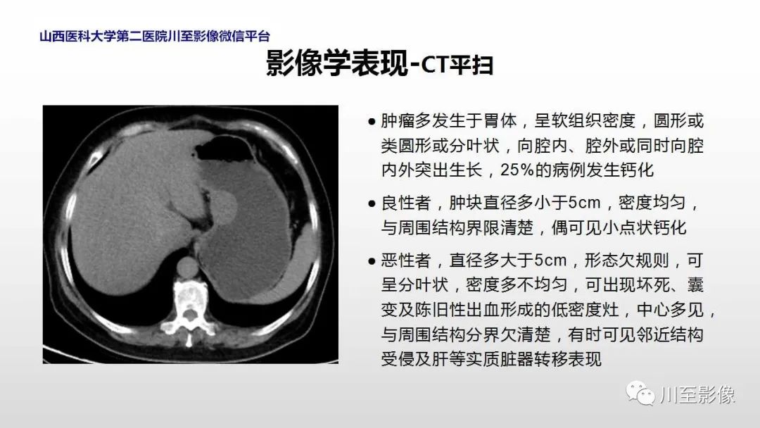 影像PPT - 【PPT】胃肠道间质瘤-19