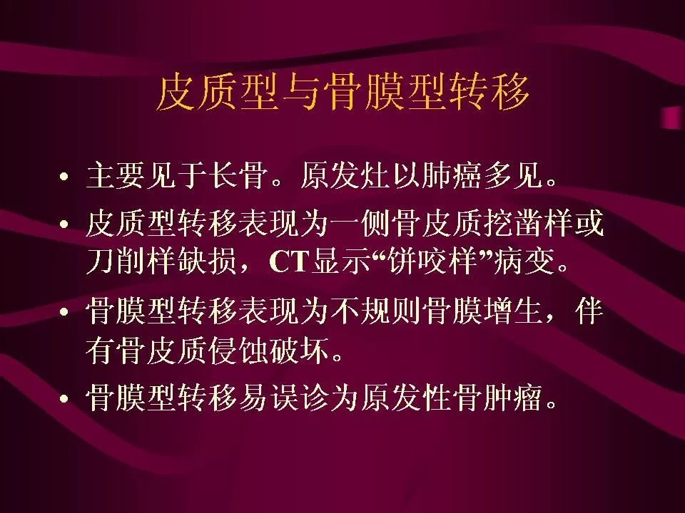 影像PPT - 【PPT】骨转移瘤的影像诊断-50