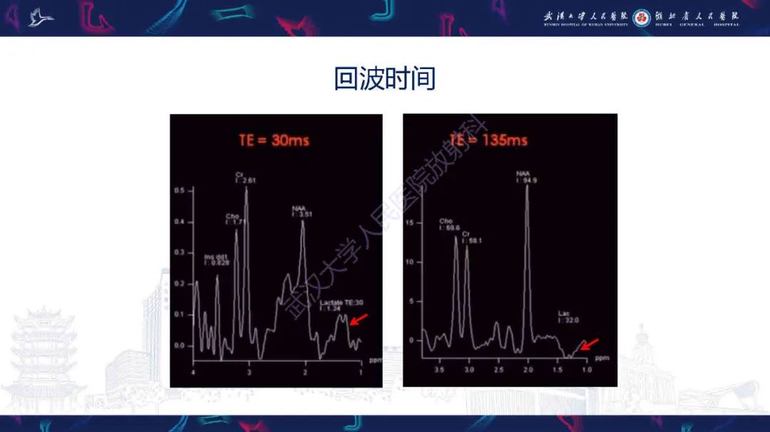 影像PPT - 【PPT】1H-MRS在中枢神经系统疾病中的应用-12