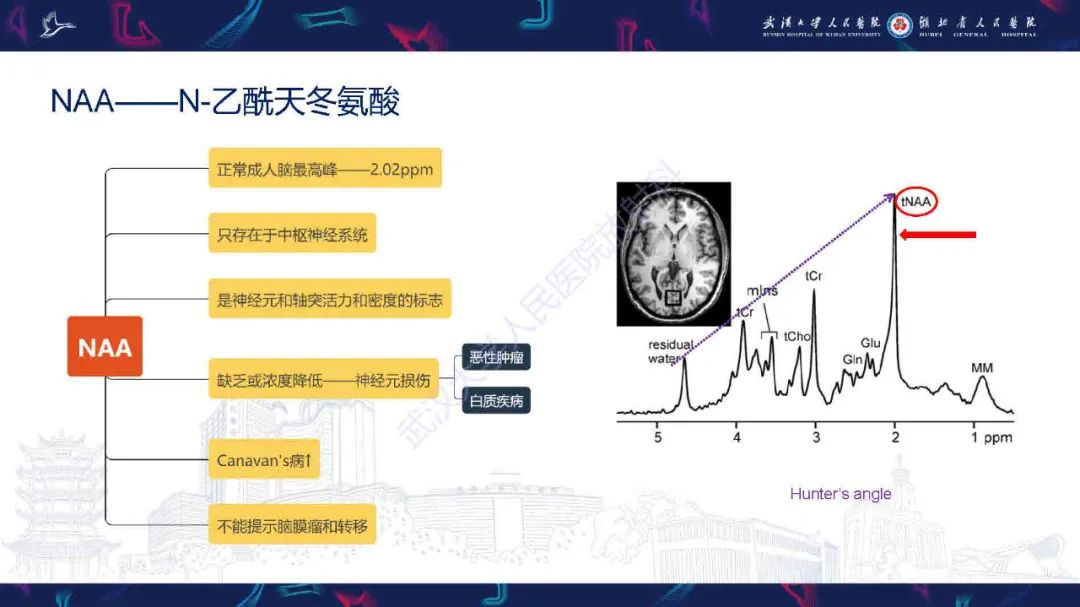 影像PPT - 【PPT】1H-MRS在中枢神经系统疾病中的应用-16