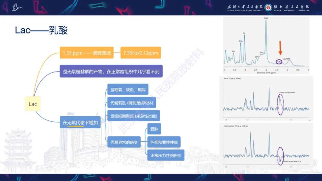 影像PPT - 【PPT】1H-MRS在中枢神经系统疾病中的应用-19