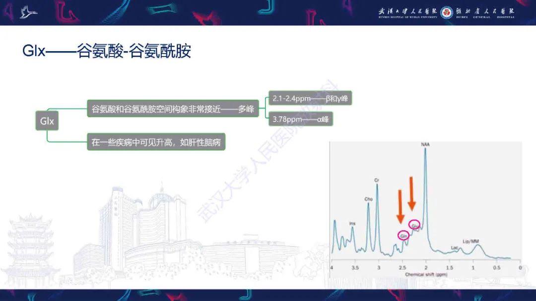 影像PPT - 【PPT】1H-MRS在中枢神经系统疾病中的应用-23