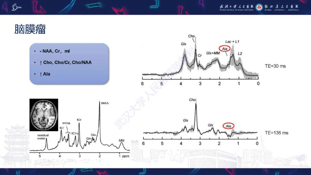 影像PPT - 【PPT】1H-MRS在中枢神经系统疾病中的应用-43