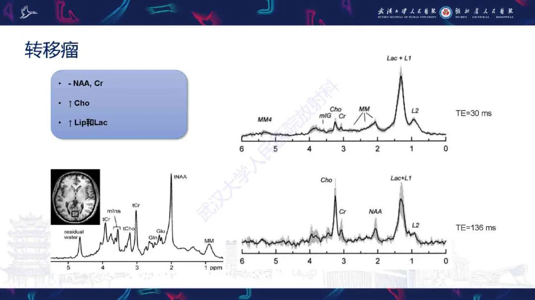 影像PPT - 【PPT】1H-MRS在中枢神经系统疾病中的应用-48