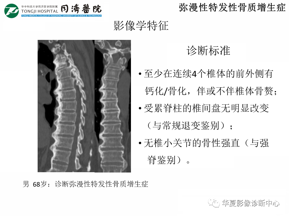 影像PPT - 【PPT】脊柱炎性病变的影像诊断思路-10