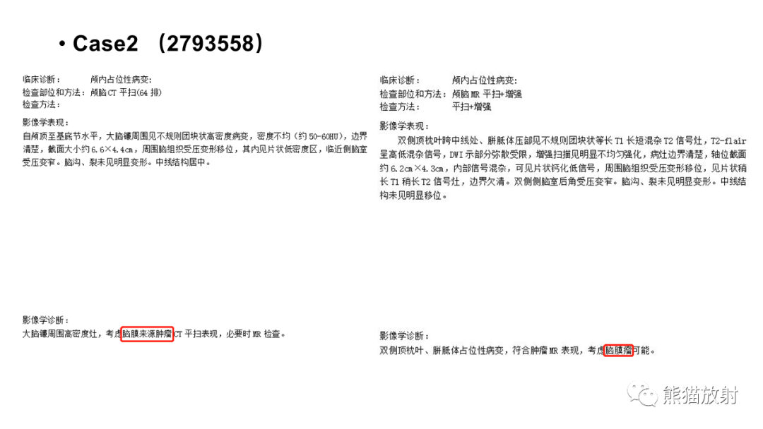 影像PPT - 【病例】颅内孤立性纤维性肿瘤2例CT及MR影像-13