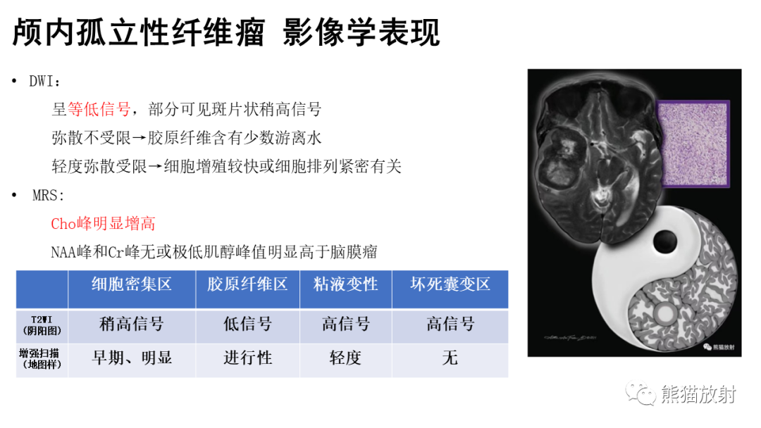 影像PPT - 【病例】颅内孤立性纤维性肿瘤2例CT及MR影像-22
