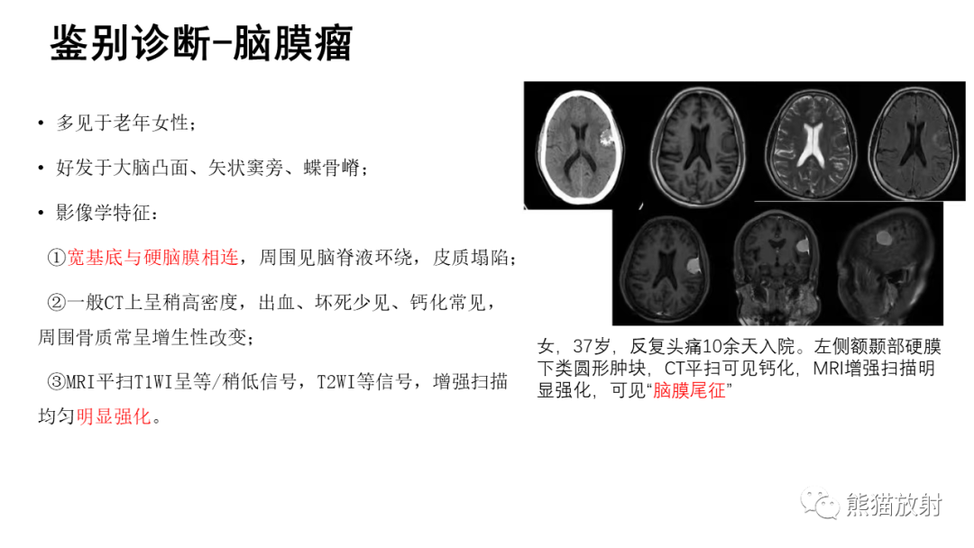 影像PPT - 【病例】颅内孤立性纤维性肿瘤2例CT及MR影像-28