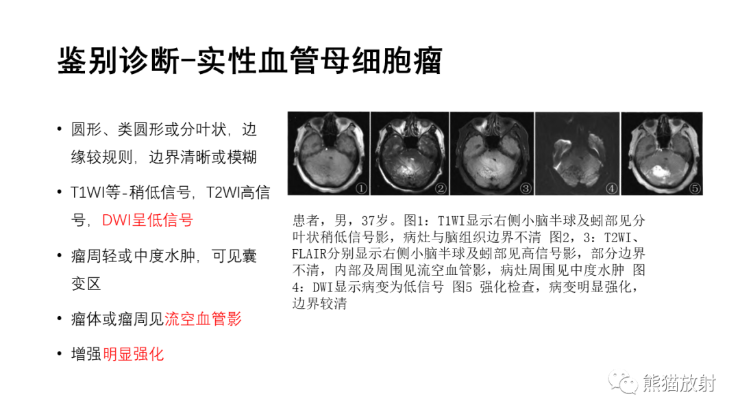 影像PPT - 【病例】颅内孤立性纤维性肿瘤2例CT及MR影像-31