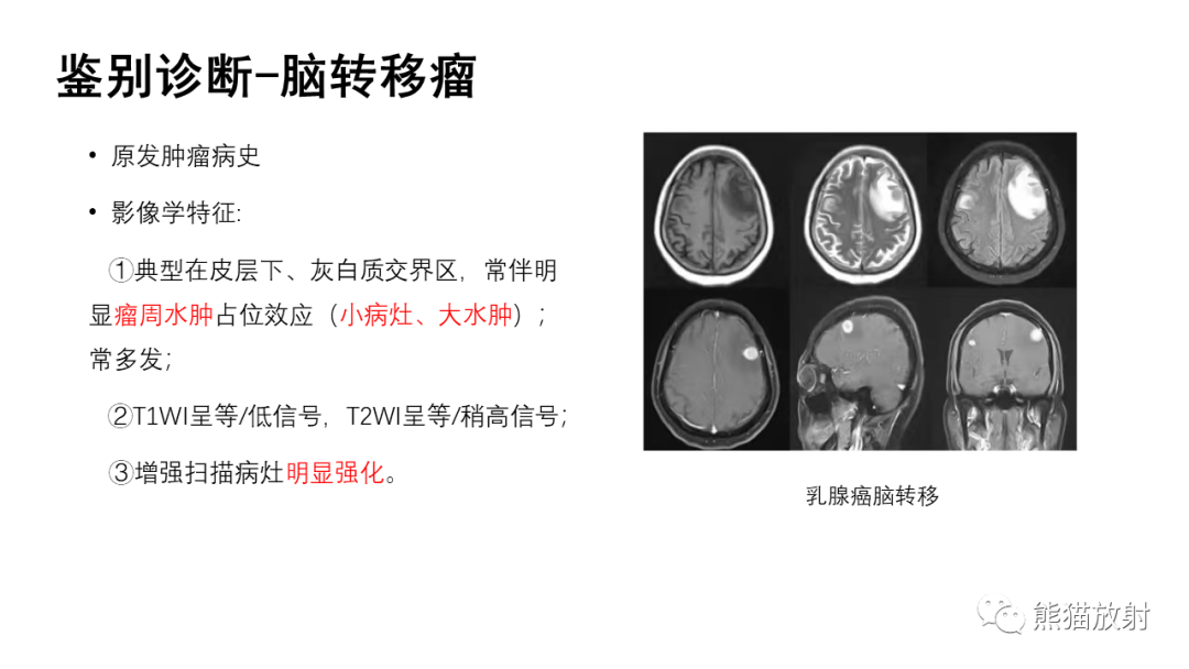 影像PPT - 【病例】颅内孤立性纤维性肿瘤2例CT及MR影像-32