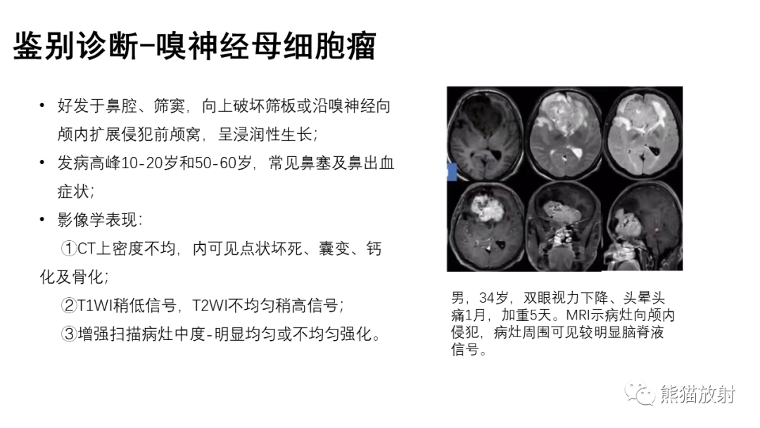 影像PPT - 【病例】颅内孤立性纤维性肿瘤2例CT及MR影像-33