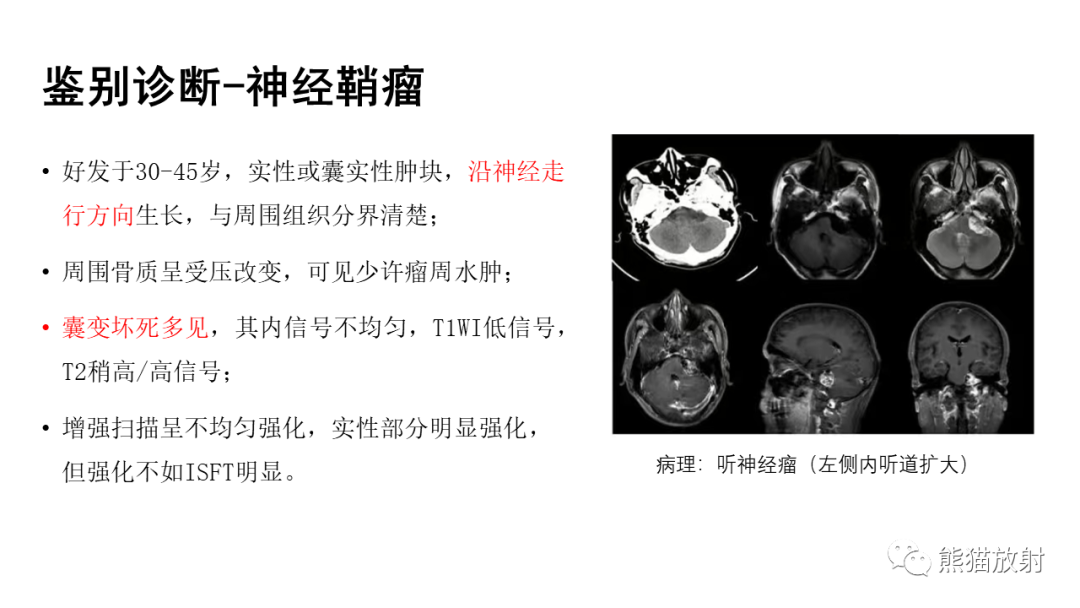 影像PPT - 【病例】颅内孤立性纤维性肿瘤2例CT及MR影像-34