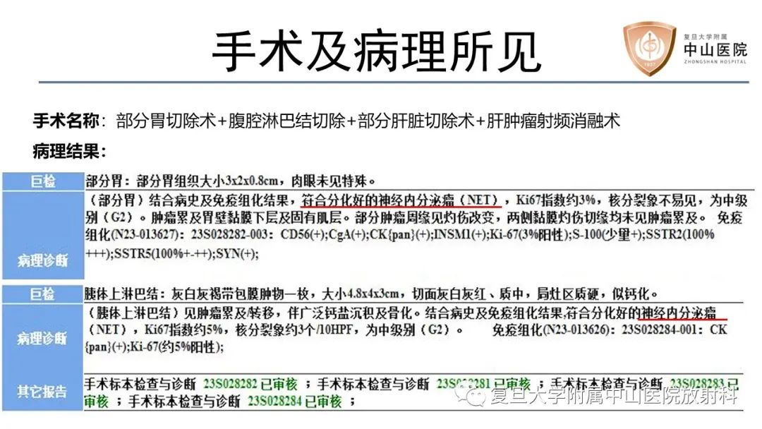 影像PPT - 【病例】胃肠道神经内分泌肿瘤1例CT及MR-10