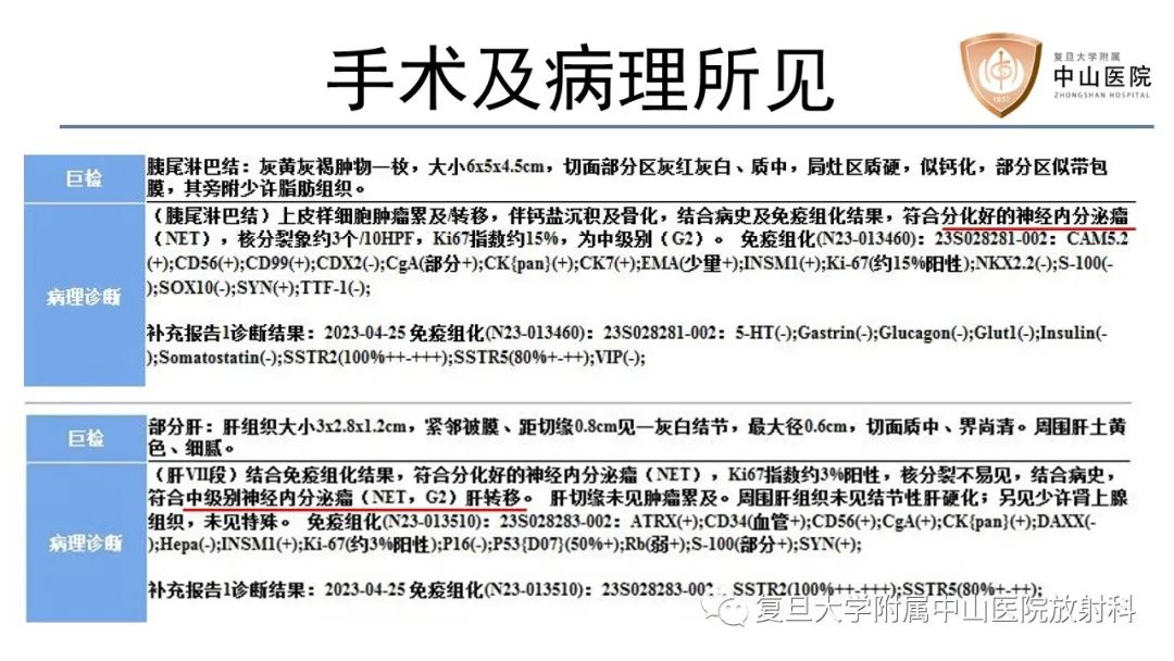 影像PPT - 【病例】胃肠道神经内分泌肿瘤1例CT及MR-11