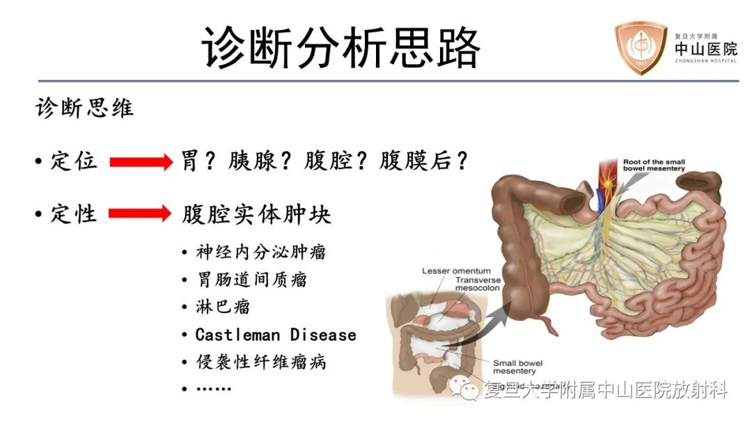 影像PPT - 【病例】胃肠道神经内分泌肿瘤1例CT及MR-12
