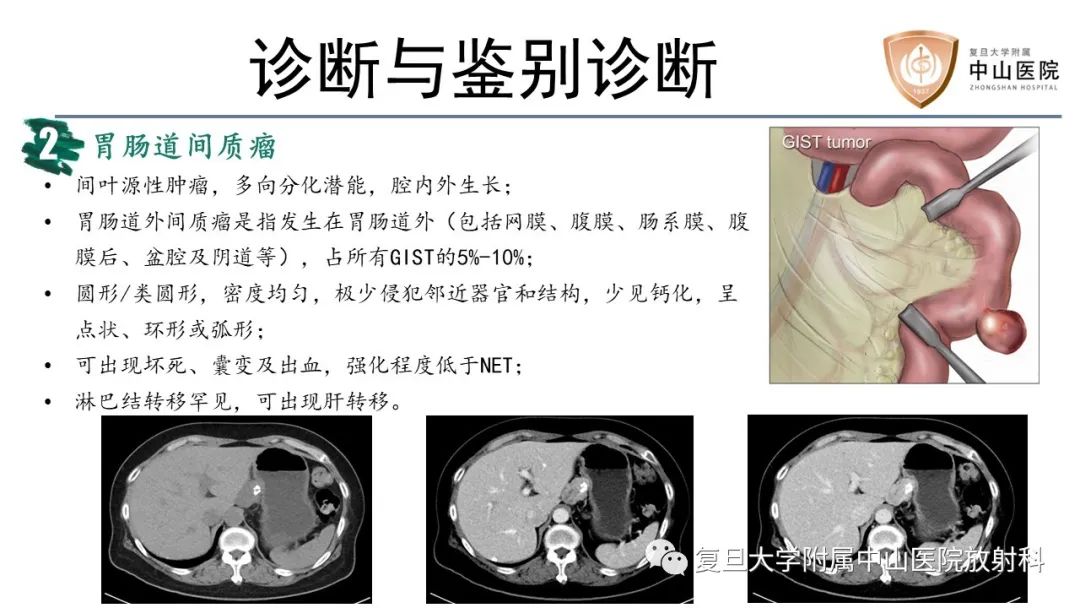 影像PPT - 【病例】胃肠道神经内分泌肿瘤1例CT及MR-16