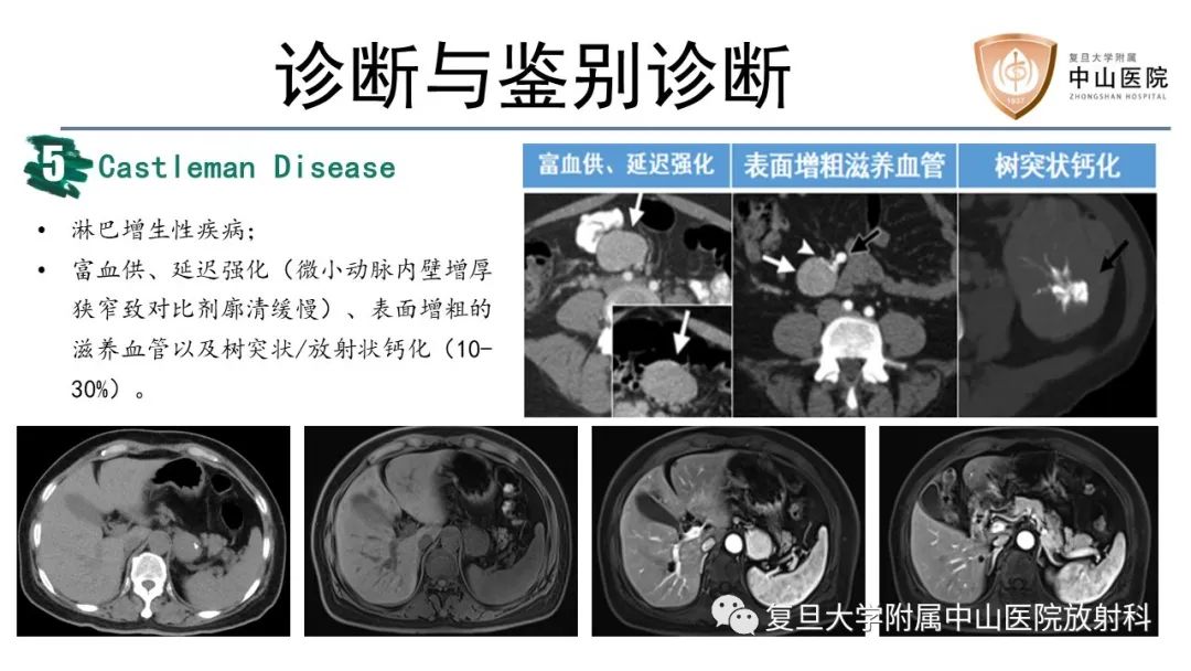 影像PPT - 【病例】胃肠道神经内分泌肿瘤1例CT及MR-19