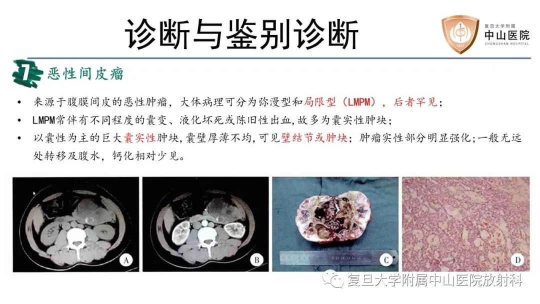 影像PPT - 【病例】胃肠道神经内分泌肿瘤1例CT及MR-21