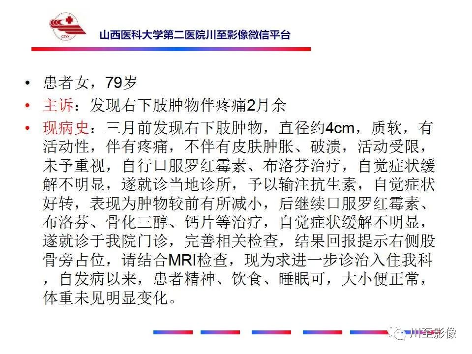 影像PPT - 【病例】大腿高级别表面骨肉瘤-2