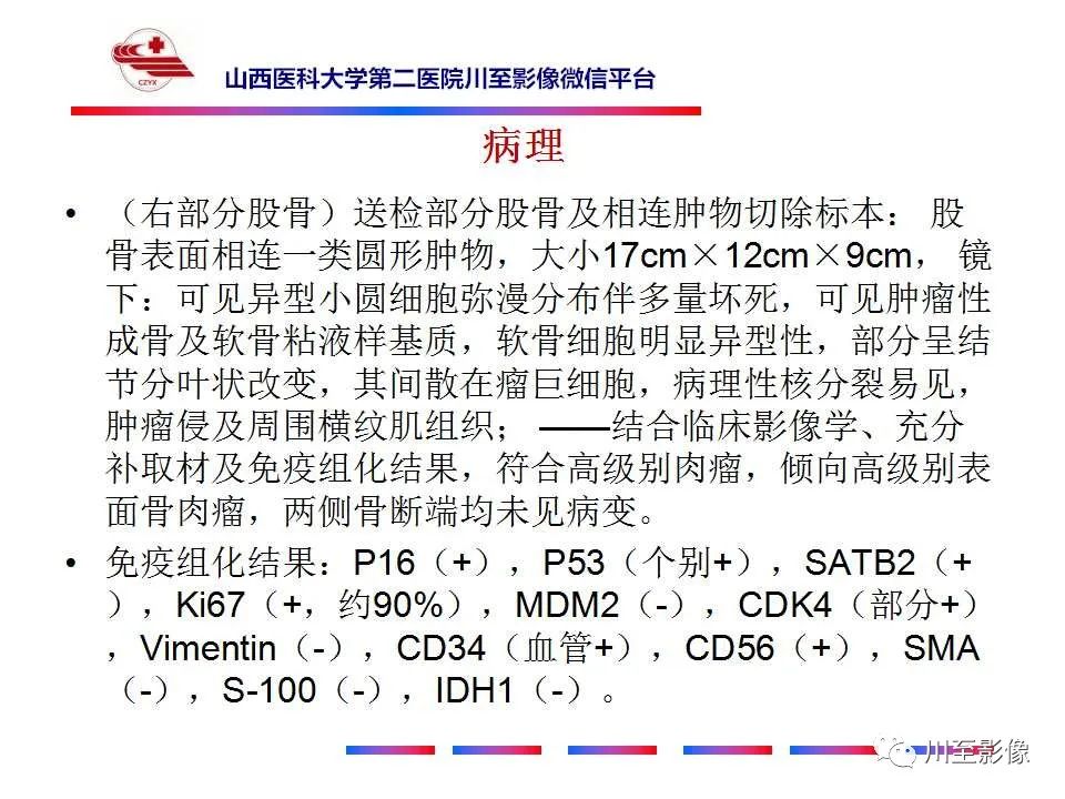 影像PPT - 【病例】大腿高级别表面骨肉瘤-21