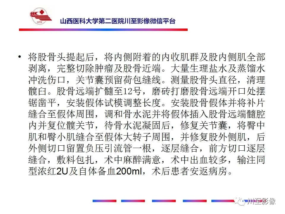 影像PPT - 【病例】大腿高级别表面骨肉瘤-20