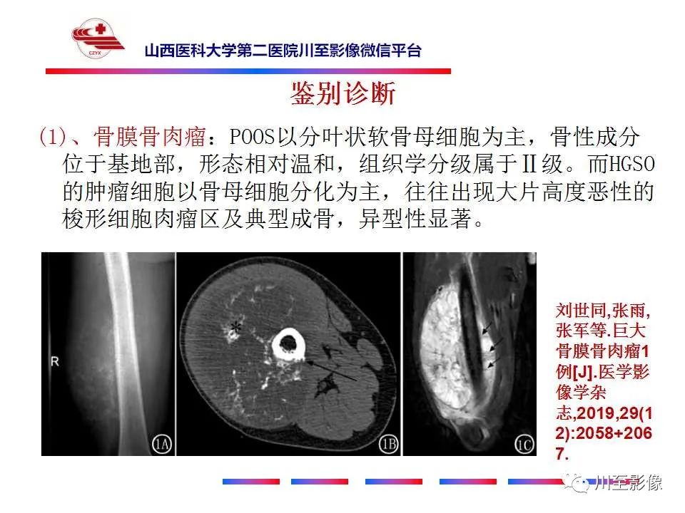 影像PPT - 【病例】大腿高级别表面骨肉瘤-32