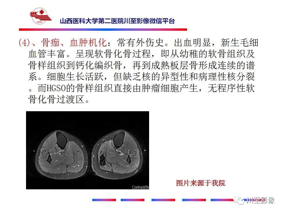影像PPT - 【病例】大腿高级别表面骨肉瘤-36