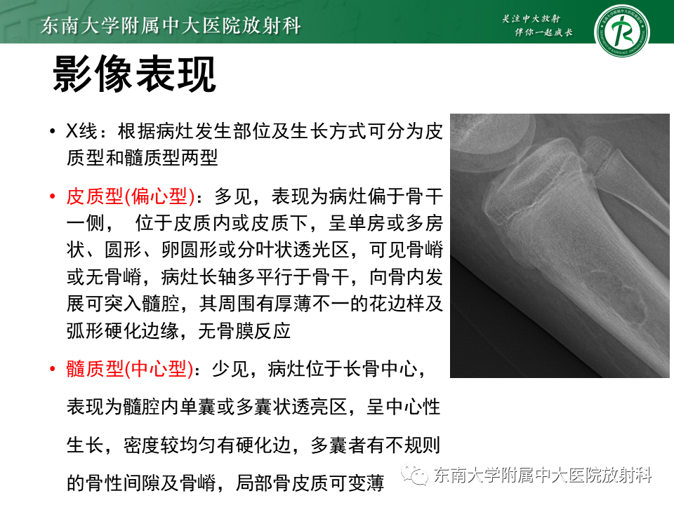 影像PPT - 【PPT】非骨化性纤维瘤-9