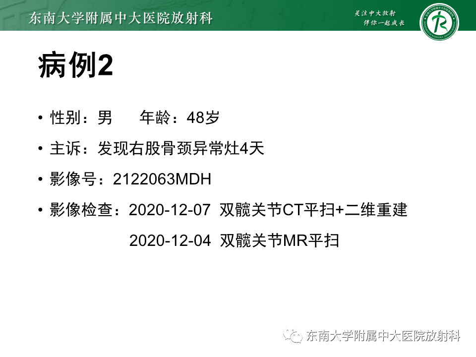 影像PPT - 【PPT】非骨化性纤维瘤-19