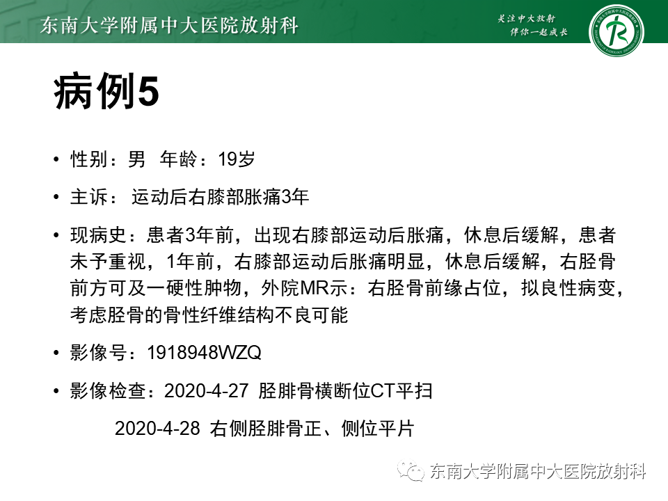 影像PPT - 【PPT】非骨化性纤维瘤-33