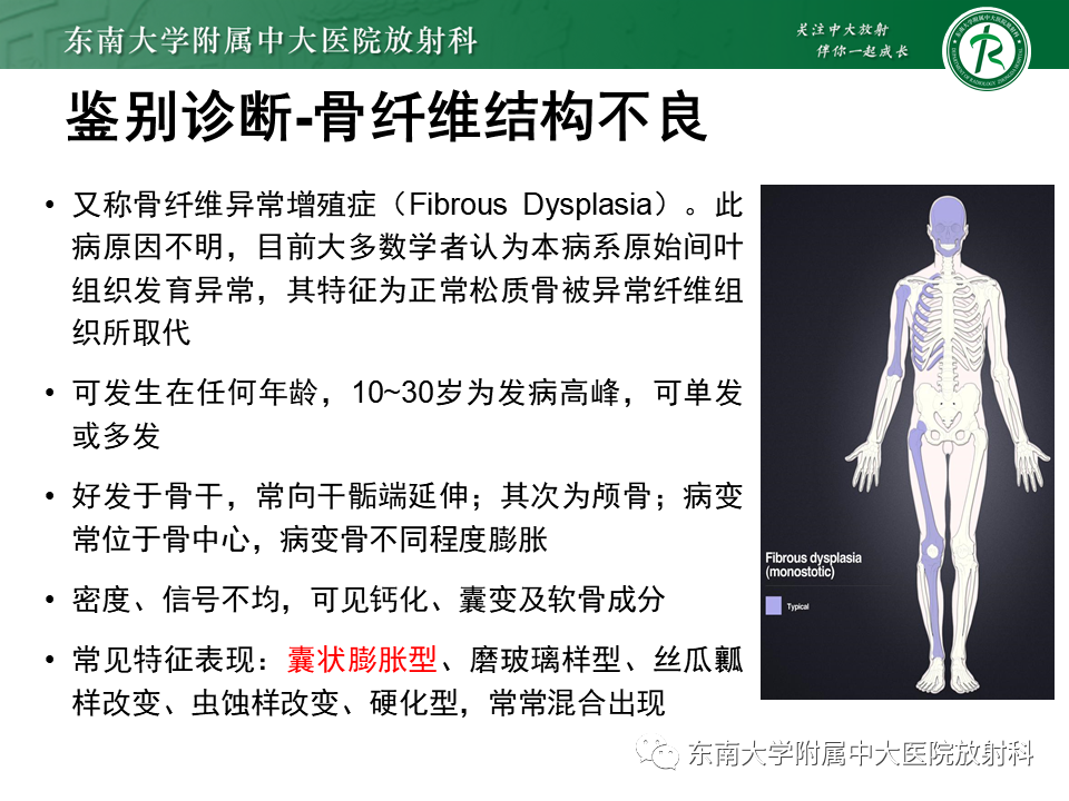 影像PPT - 【PPT】非骨化性纤维瘤-41
