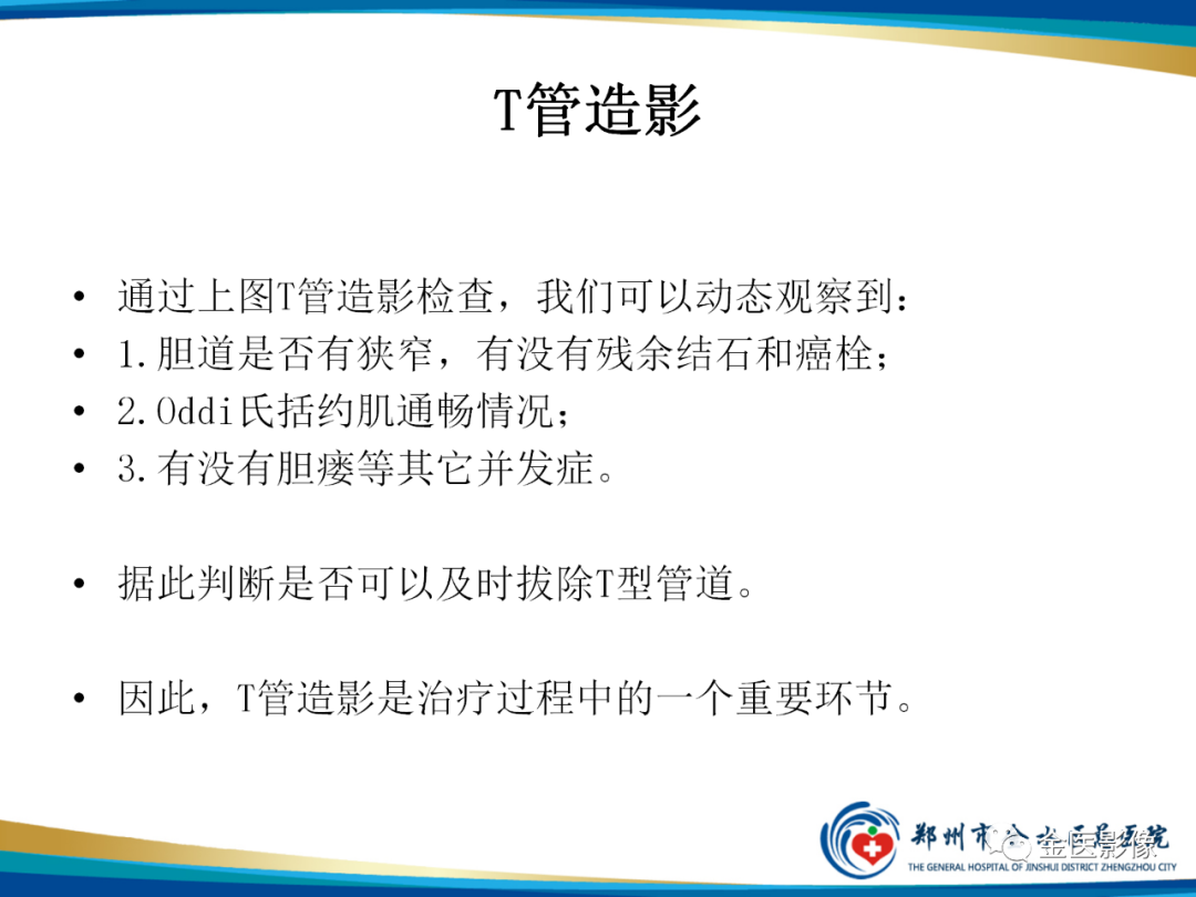 影像PPT - 【PPT】造影检查技术篇之T管造影-9