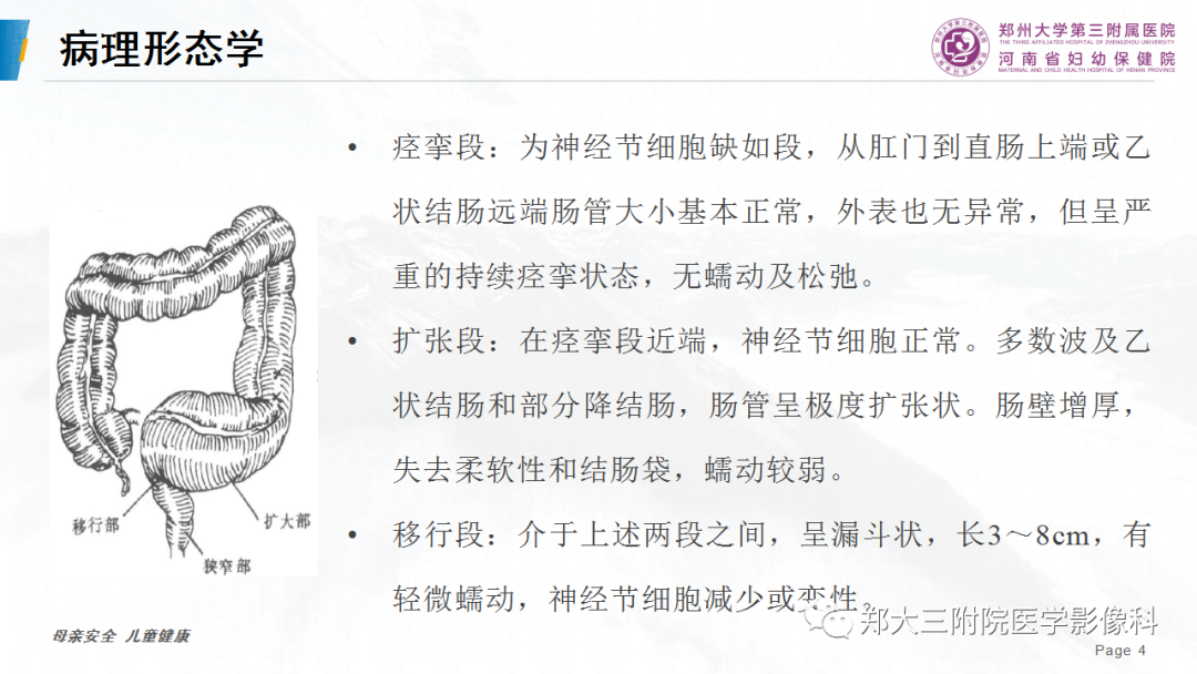 影像PPT - 【PPT】先天性巨结肠-4