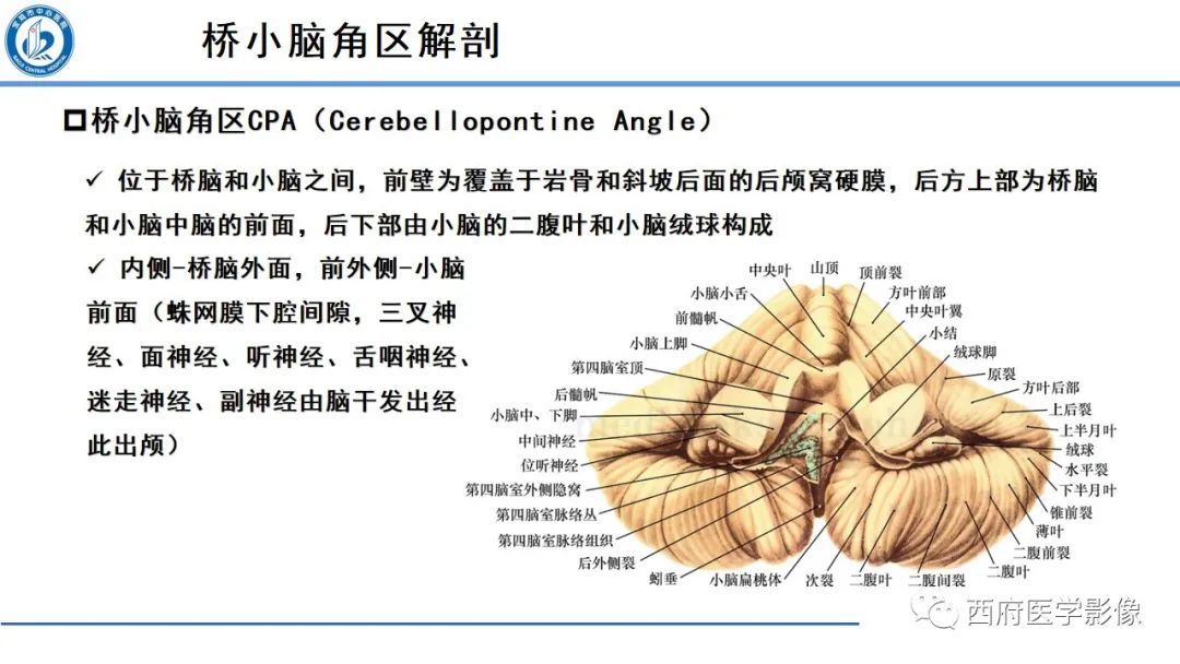 影像PPT - 【PPT】桥小脑角区占位性病变影像诊断与鉴别-3