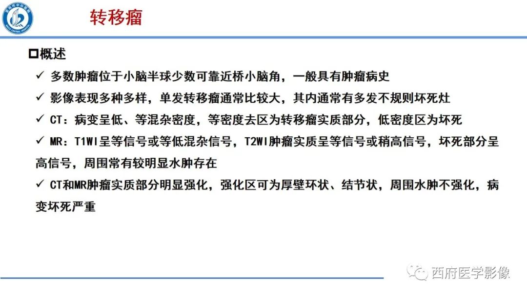 影像PPT - 【PPT】桥小脑角区占位性病变影像诊断与鉴别-44
