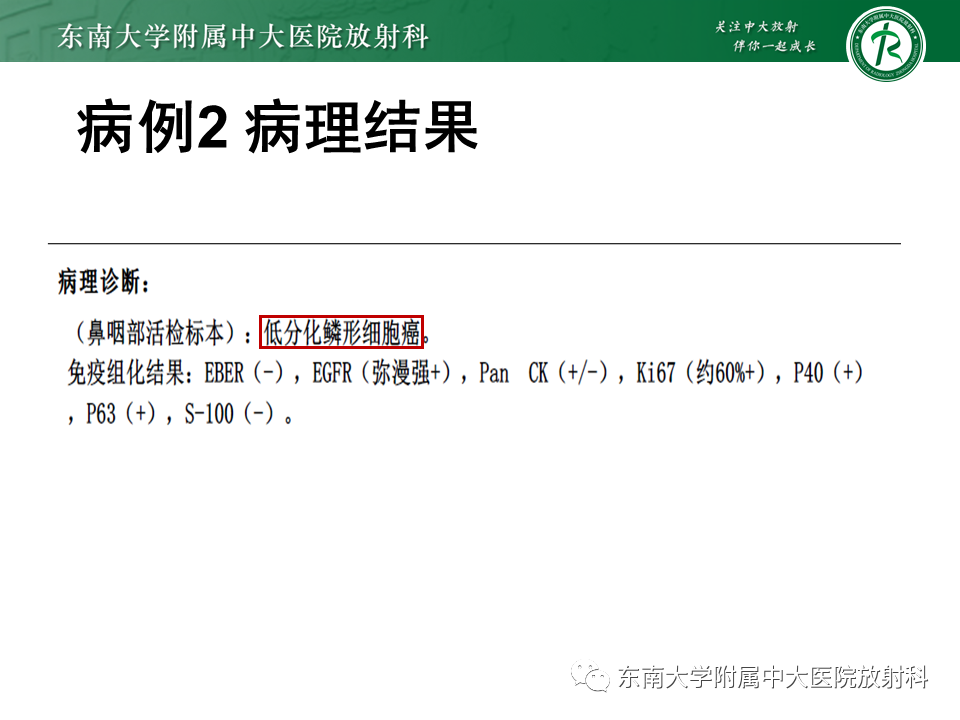 影像PPT - 【PPT】鼻咽癌影像及分期-12