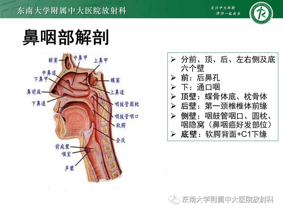 影像PPT - 【PPT】鼻咽癌影像及分期-14