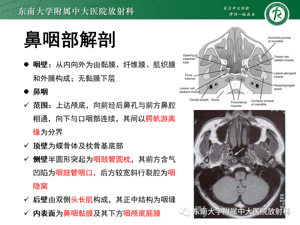 影像PPT - 【PPT】鼻咽癌影像及分期-15
