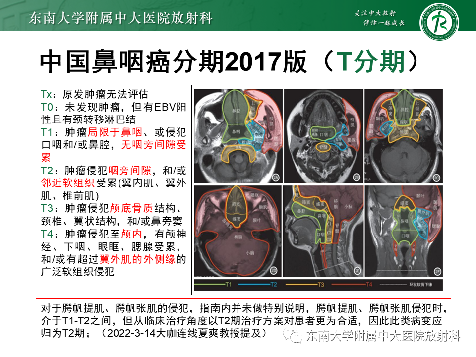 影像PPT - 【PPT】鼻咽癌影像及分期-27