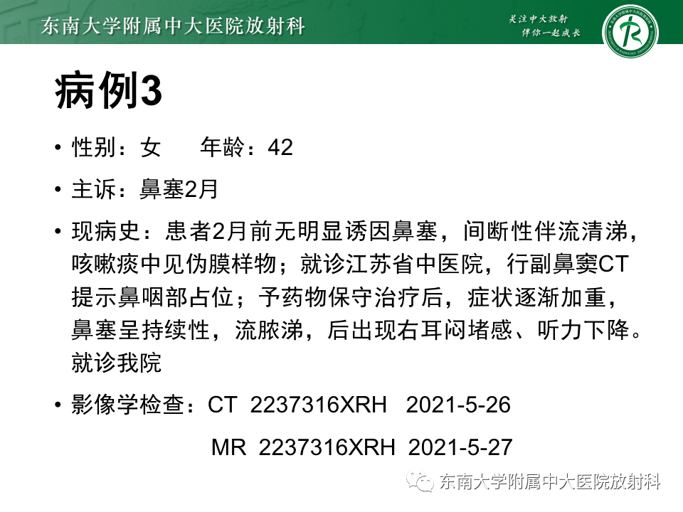 影像PPT - 【PPT】鼻咽癌影像及分期-37