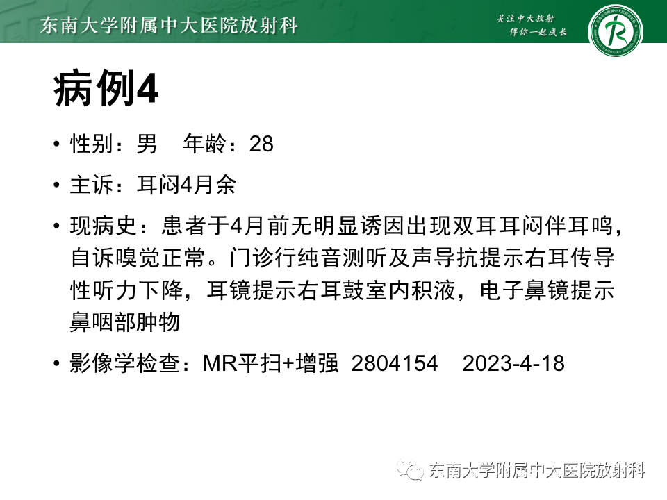 影像PPT - 【PPT】鼻咽癌影像及分期-42