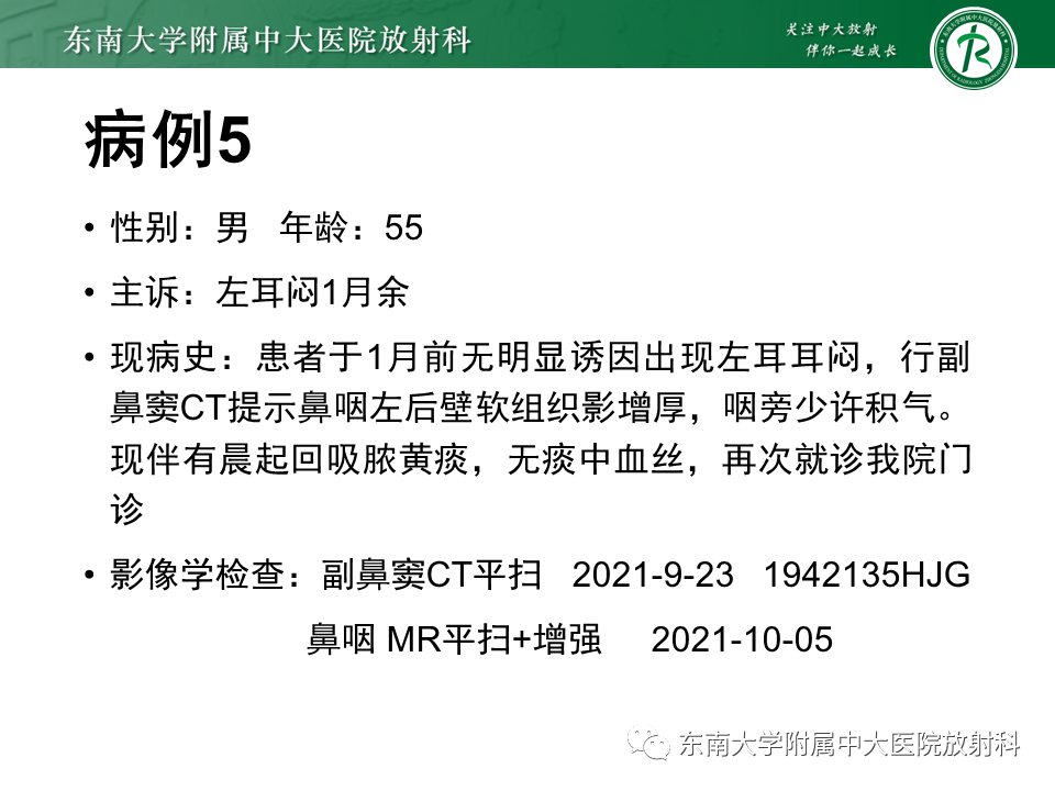 影像PPT - 【PPT】鼻咽癌影像及分期-49