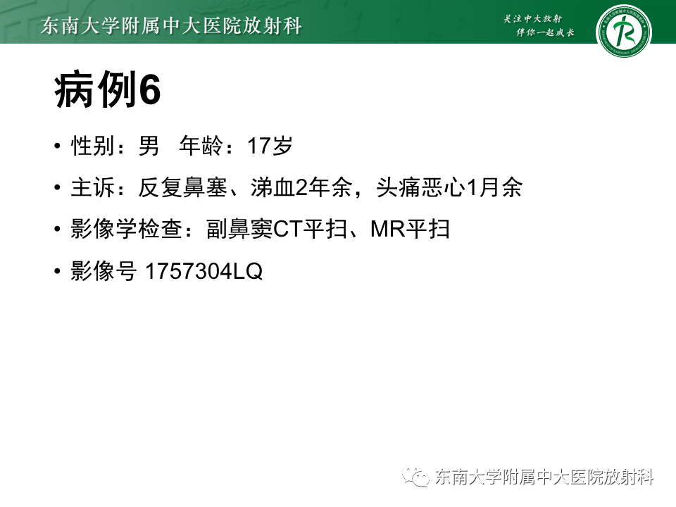 影像PPT - 【PPT】鼻咽癌影像及分期-53