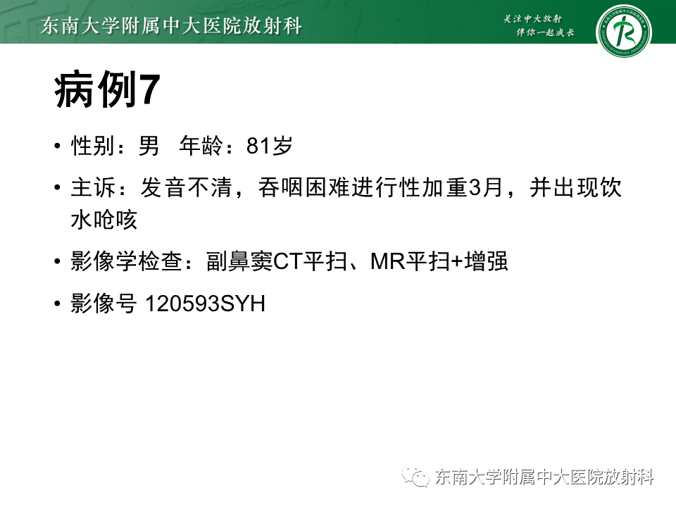 影像PPT - 【PPT】鼻咽癌影像及分期-57