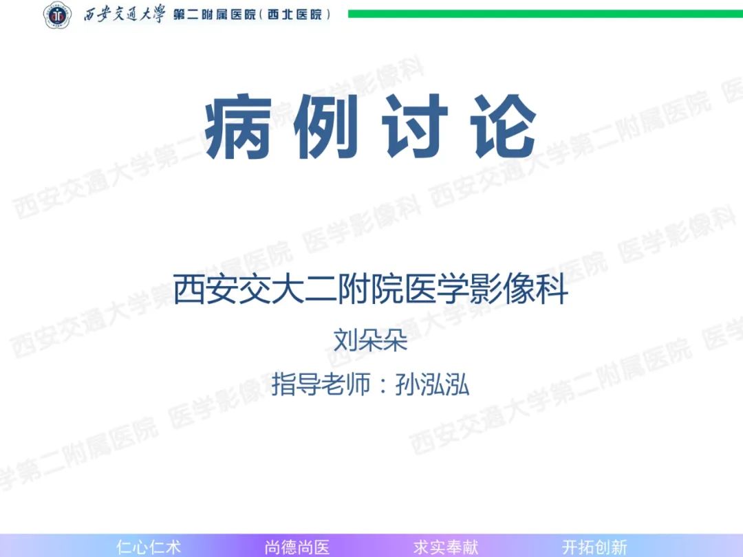 影像PPT - 【病例】肝融合性纤维化1例CT及MR影像-1